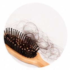 Hair brush with fallen hair – hair fall control